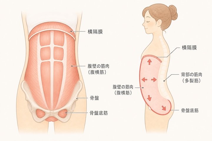 腹直筋離開の詳細と断面図
